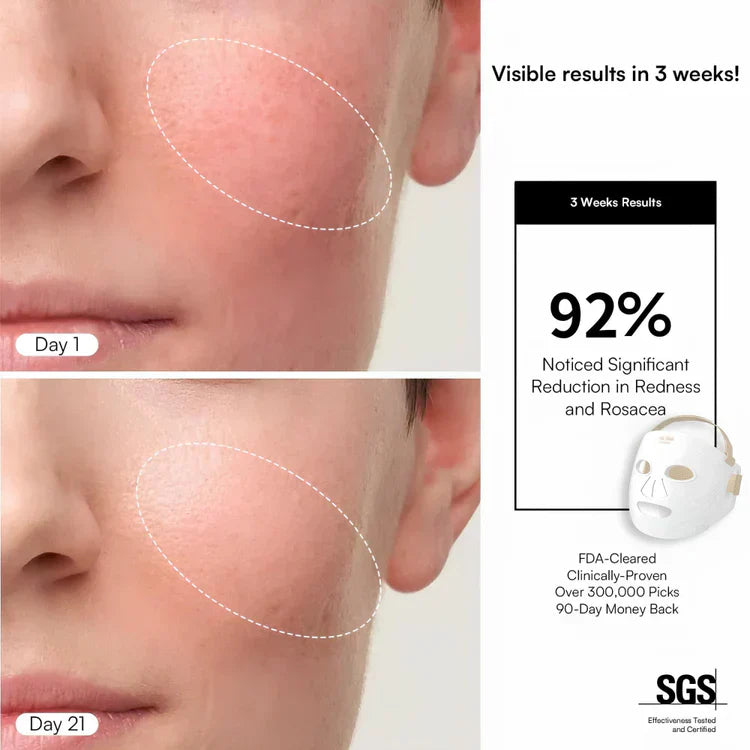LUMI LED Light Therapy Skincare Mask