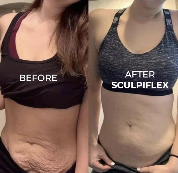 Sculpiflex Full Kit